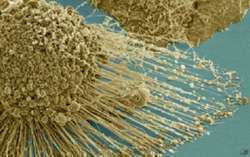 Cientistas norte-americanos desenvolvem nanopartículas que matam as células cancerígenas e impede que a doença se espalhe. Foto: AP