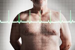 A cada dez anos com colesterol alto, risco de infarto cresce 40% 