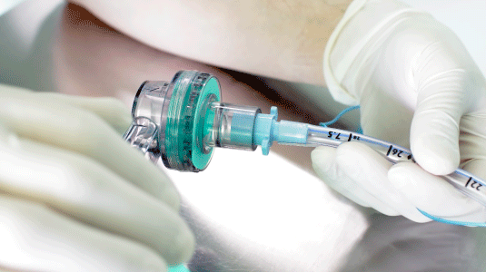 Foto com destaque para as mãos de um homem branco com luvas brancas de látex ajustando um equipamento para intubação de paciente 